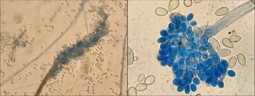 Lichtmikroskopische Untersuchung von Schimmelpilzen. Links Doratomyces sp. und rechts Botrytis sp.